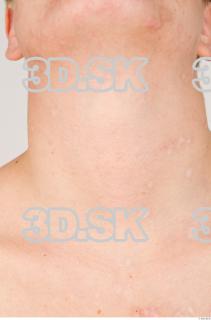 Neck texture of Pat 0001